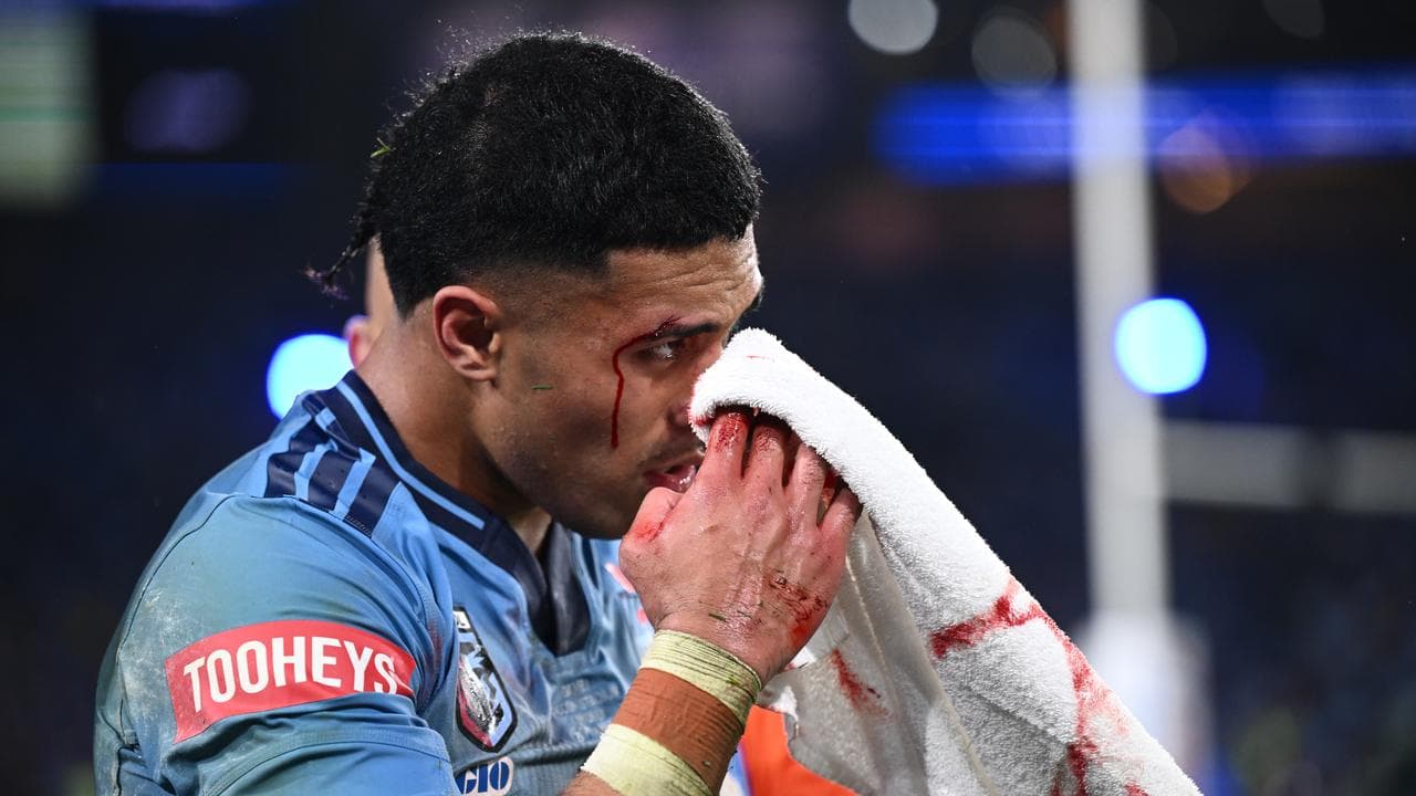 Manly seek exemption to play Koula after Origin knock