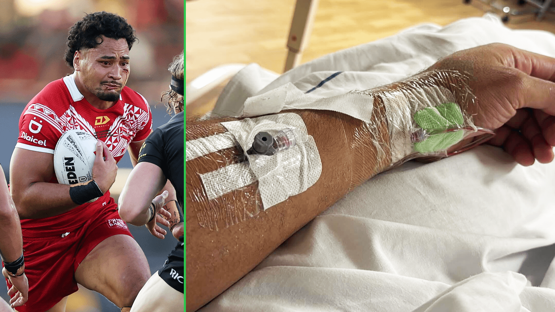 Eli Katoa undergoes surgery after trio of head knocks vs Kiwis